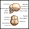 Skull of a newborn