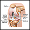 Knee arthroscopy - series - Normal anatomy