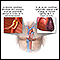 Acute vs. chronic conditions