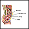 Amniocentesis - series - Indication