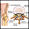 Intervertebral disk