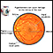 Hypertensive retinopathy