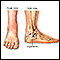 Ankle sprain - Series