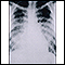 Chickenpox, acute pneumonia - chest X-ray