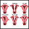 Congenital uterine anomalies