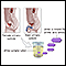 Aminoaciduria urine test