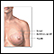 Normal female breast anatomy