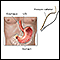 Esophageal manometry