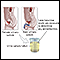 Catecholamine urine test