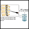 CSF protein test