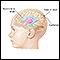 Intracranial pressure monitoring