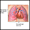 Primary pulmonary hypertension