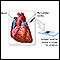 Pericardial fluid culture